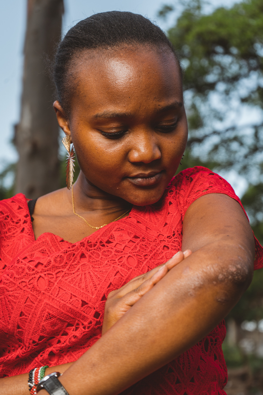 Psoriasis Association of Kenya community gathering